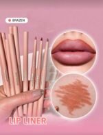 ⁦محددات شيجلام⁩ - الصورة ⁦5⁩