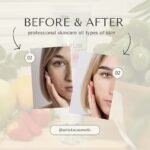 ⁦Skin balanced⁩ - الصورة ⁦3⁩