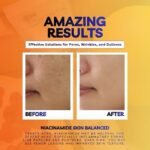 ⁦Skin balanced⁩ - الصورة ⁦2⁩